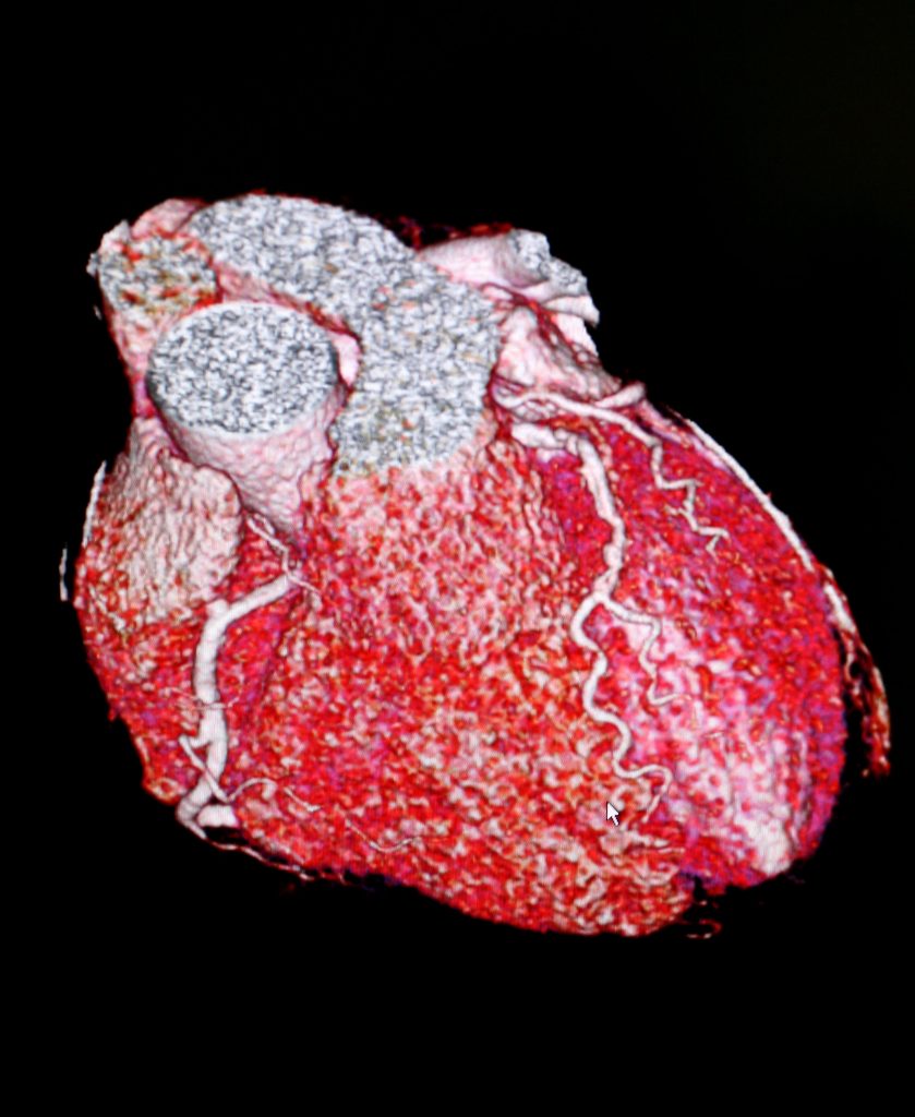 Healthy hearts initiative to tackle cardiovascular disease across region