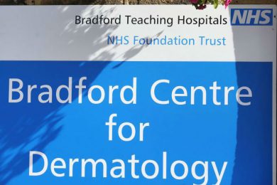 Skin doctors seek pioneering treatment for psoriasis